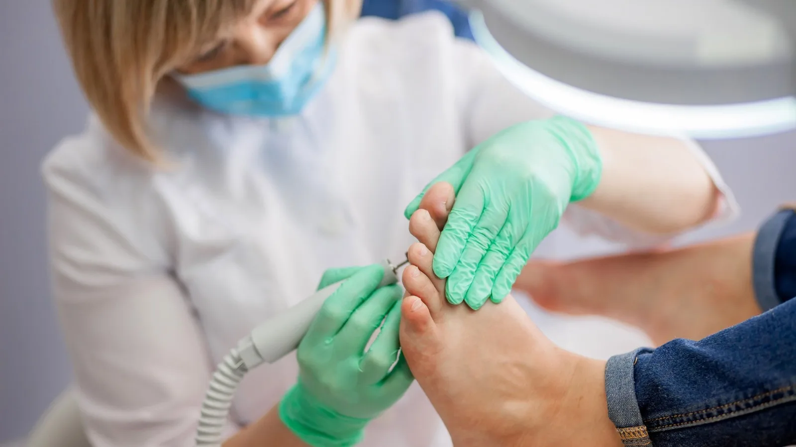 Soluciones Expertas para las Durezas en los Pies en CDMX