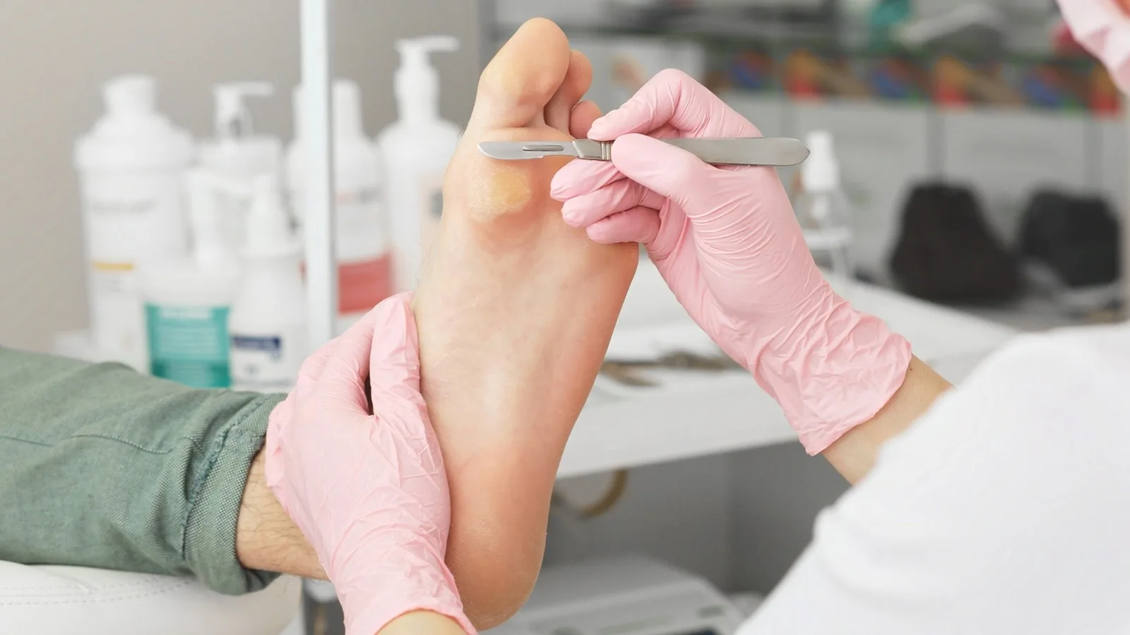 Tratamiento Integral para Infecciones Bacterianas del Pie en CDMX