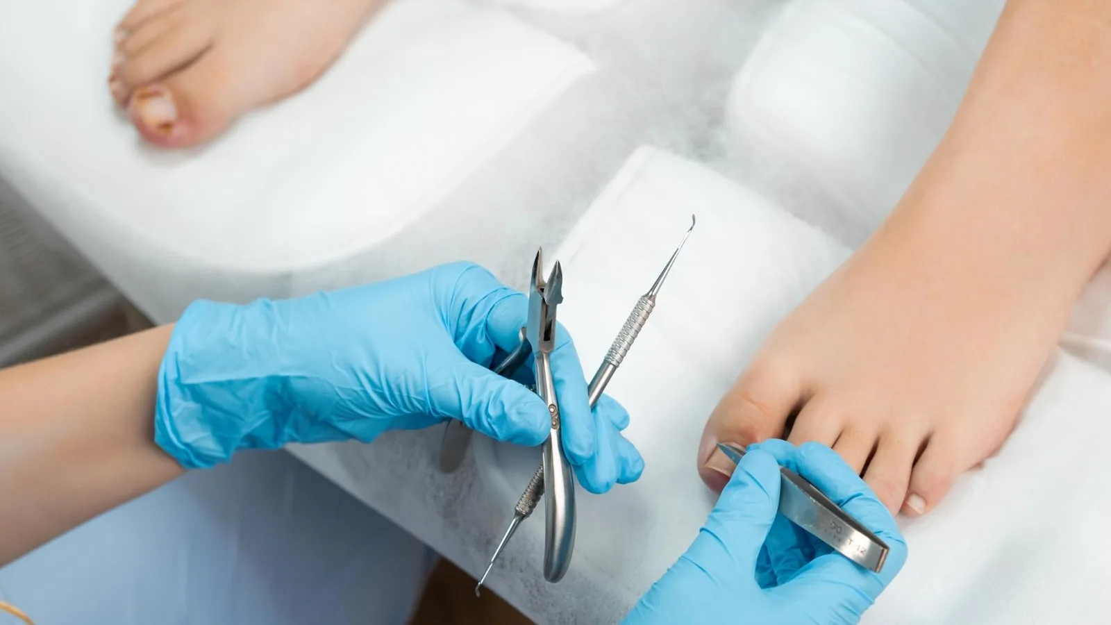 Soluciones Expertas para Uñas Deformadas en CDMX
